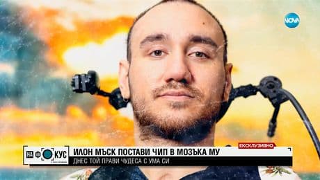 изображение на ЕКСКЛУЗИВНО: Говори първият човек в света с чип в мозъка