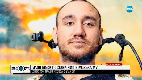 изображение на ЕКСКЛУЗИВНО: Говори първият човек в света с чип в мозъка