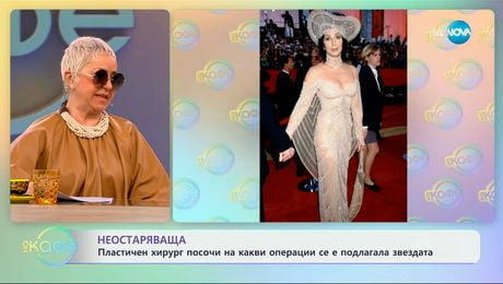 изображение на Пластичен хирург посочи на какви операции се е подлагала Шер - „На кафе“ (19.02.2025)