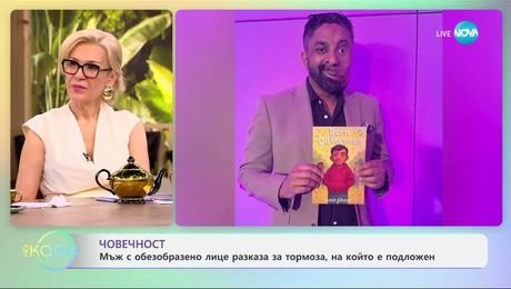 изображение на Мъж с обезобразено лице разказа за тормоза, на който е подложен - „На кафе“ (21.05.2025)