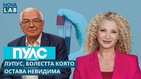 изображение на Лупус, болестта която остава невидима | Проф. Румен Стоилов - ревматолог | NOVA LAB Пулс