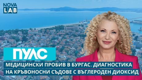 изображение на Диагностика на кръвоносни съдове с въглероден диоксид | NOVA LAB Пулс