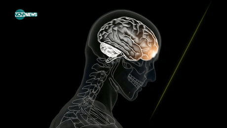 изображение на VOA технологии: Мозъкът - част 2